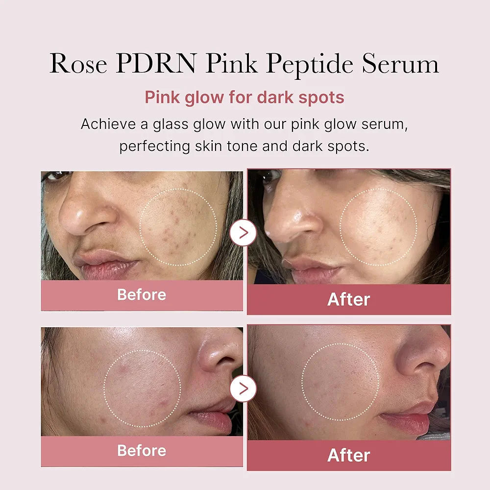 MEDICUBE PDRN PDRN PINK PEPTIDE SERUM 30ML